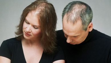 اسباب وعلاج تساقط الشعر